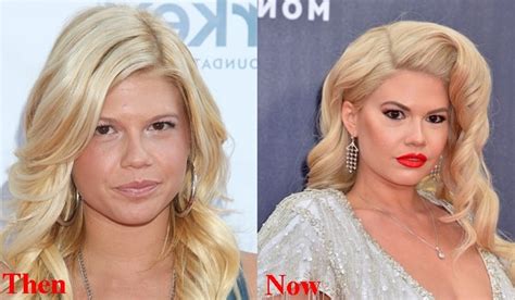 chanel west coast before|chanel west coast implants.